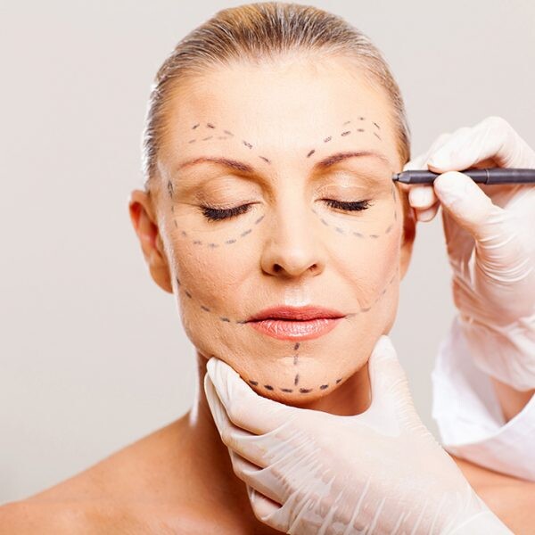 Lifting facial: cuidados com     a face