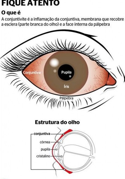 Outono: a estação das alergias oculares