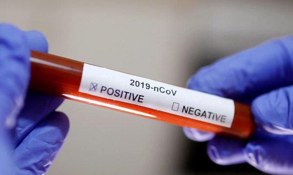 Brasil tem segundo caso de coronavírus confirmado na tarde de hoje