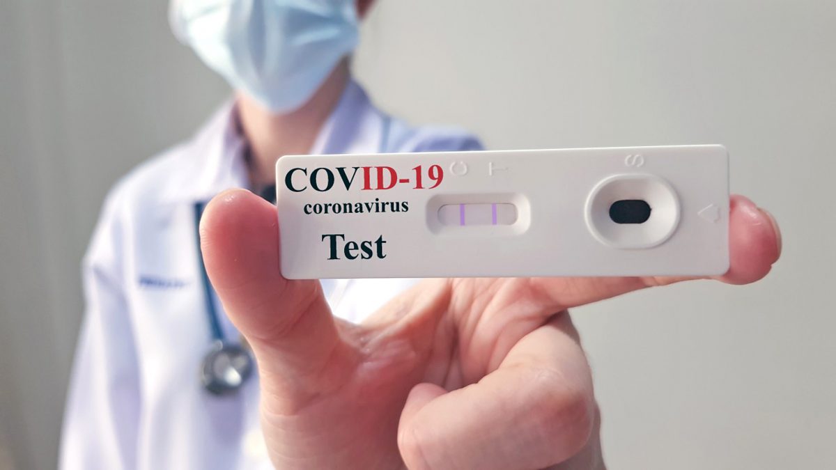 Planos de saúde devem cobrir teste de covid-19, determina ANS