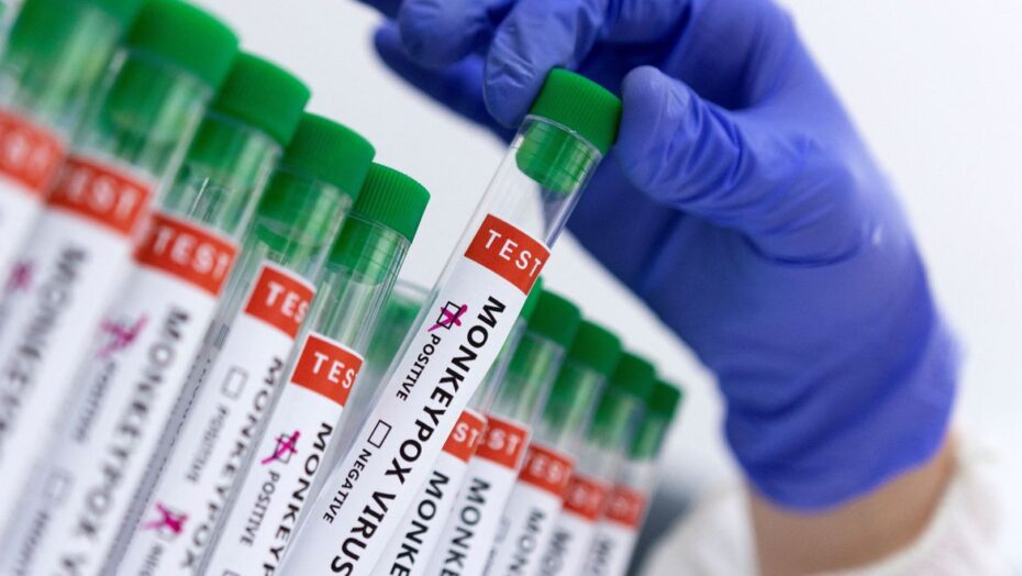 Primeiro caso de varíola dos macacos é confirmado em Lajeado