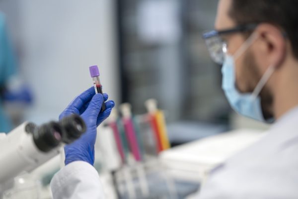Panvel faz testes gratuitos para identificação de leptospirose